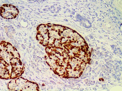 IHC of Glucagon EP74 on a FFPE Pancreas Tissue
